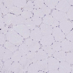 Invitrogen SSR4 Polyclonal Antibody 100 &mu;L; Unconjugated:Antibodies,