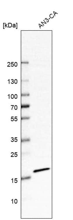 Invitrogen SSR4 Polyclonal Antibody 100 &mu;L | Buy Online | Invitrogen&trade; | Fisher Scientific