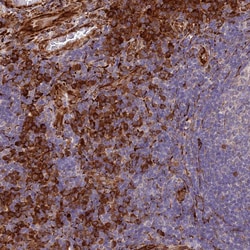 Invitrogen NDUFAF7 Polyclonal Antibody 100 &mu;L | Buy Online | Invitrogen&trade; | Fisher Scientific