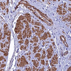 Invitrogen FADS3 Polyclonal Antibody 100 &mu;L; Unconjugated:Antibodies,