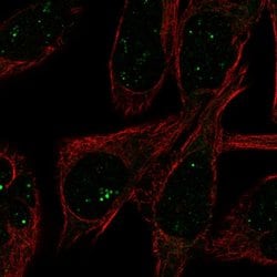 Invitrogen FADS3 Polyclonal Antibody 100 &mu;L; Unconjugated:Antibodies,