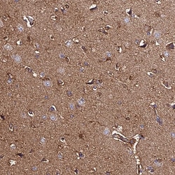 C2orf69 Polyclonal Antibody:Antibodies, Polyclonal