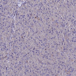 C2orf69 Polyclonal Antibody:Antibodies, Polyclonal