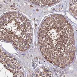C2orf69 Polyclonal Antibody:Antibodies, Polyclonal