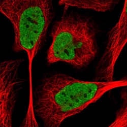Invitrogen SIK3 Polyclonal Antibody 100 &mu;L; Unconjugated:Antibodies,