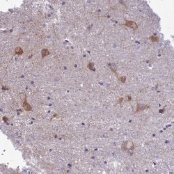 Invitrogen PCDHB14 Polyclonal Antibody 100 &mu;L | Buy Online | Invitrogen&trade; | Fisher Scientific
