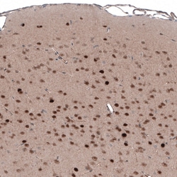 Invitrogen SCRT1 Polyclonal Antibody 100 &mu;L; Unconjugated:Antibodies,