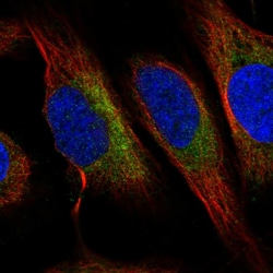 Invitrogen C6orf47 Polyclonal Antibody 100 &mu;L | Buy Online | Invitrogen&trade; | Fisher Scientific