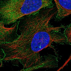 Invitrogen WAVE2 Polyclonal Antibody 100 &mu;L; Unconjugated:Antibodies,