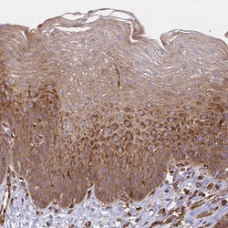 Invitrogen WAVE2 Polyclonal Antibody 100 &mu;L; Unconjugated:Antibodies,