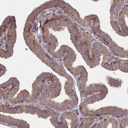 Invitrogen WAVE2 Polyclonal Antibody 100 &mu;L; Unconjugated:Antibodies,