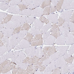 Invitrogen WAVE2 Polyclonal Antibody 100 &mu;L; Unconjugated:Antibodies,