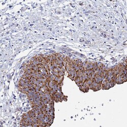 Invitrogen ANKRD34C Polyclonal Antibody 100 &mu;L; Unconjugated:Antibodies,