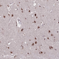 Invitrogen ZBED4 Polyclonal Antibody 100 &mu;L; Unconjugated:Antibodies,