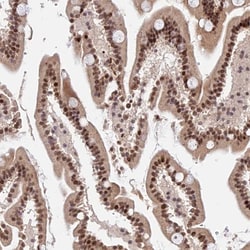 Invitrogen ZBED4 Polyclonal Antibody 100 &mu;L; Unconjugated:Antibodies,