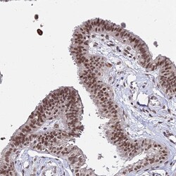 Invitrogen ZBED4 Polyclonal Antibody 100 &mu;L; Unconjugated:Antibodies,