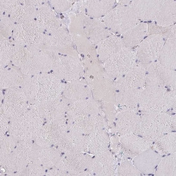 Invitrogen HTRA4 Polyclonal Antibody 100 &mu;L; Unconjugated:Antibodies,