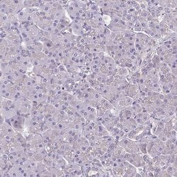 Invitrogen HTRA4 Polyclonal Antibody 100 &mu;L; Unconjugated:Antibodies,