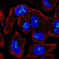 Invitrogen M1AP Polyclonal Antibody 100 &mu;L; Unconjugated:Antibodies,