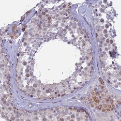 Invitrogen M1AP Polyclonal Antibody 100 &mu;L; Unconjugated:Antibodies,