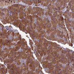 Invitrogen™ COMMD10 Polyclonal Antibody