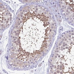 Invitrogen LDHC Polyclonal Antibody 100 &mu;L; Unconjugated:Antibodies,