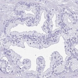 Invitrogen LDHC Polyclonal Antibody 100 &mu;L; Unconjugated:Antibodies,