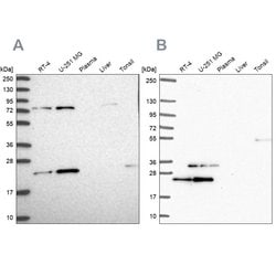 Invitrogen eIF3k Polyclonal Antibody 100 &mu;L; Unconjugated:Antibodies,