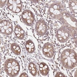 Invitrogen LARS2 Polyclonal Antibody 100 &mu;L; Unconjugated:Antibodies,