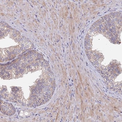 Invitrogen MRP7 Polyclonal Antibody 100 &mu;L; Unconjugated:Antibodies,