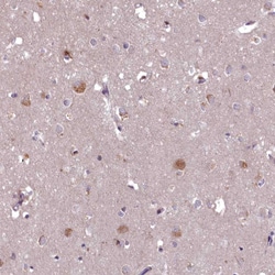 Invitrogen EFHA1 Polyclonal Antibody 100 &mu;L; Unconjugated:Antibodies,