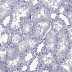 Invitrogen IL17REL Polyclonal Antibody 100 &mu;L; Unconjugated:Antibodies,