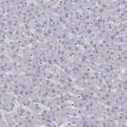 Invitrogen IL17REL Polyclonal Antibody 100 &mu;L; Unconjugated:Antibodies,