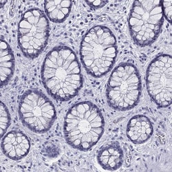 Invitrogen IL17REL Polyclonal Antibody 100 &mu;L; Unconjugated:Antibodies,