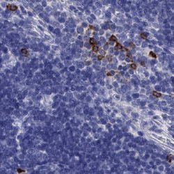 Invitrogen IL17REL Polyclonal Antibody 100 &mu;L; Unconjugated:Antibodies,