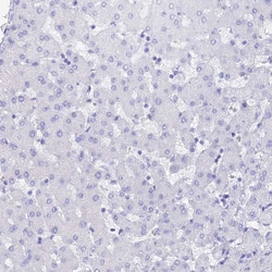 Invitrogen REG1A Polyclonal Antibody 100 &mu;L; Unconjugated:Antibodies,