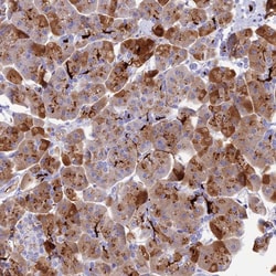 Invitrogen REG1A Polyclonal Antibody 100 &mu;L; Unconjugated:Antibodies,