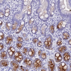 Invitrogen REG1A Polyclonal Antibody 100 &mu;L; Unconjugated:Antibodies,