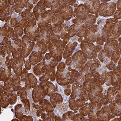 Invitrogen TCP-1 zeta Polyclonal Antibody 100 &mu;L; Unconjugated:Antibodies,