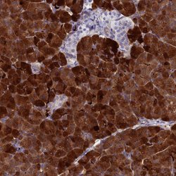 Invitrogen REG1A Polyclonal Antibody 100 &mu;L; Unconjugated:Antibodies,