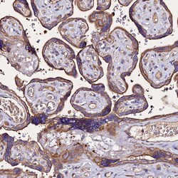 Invitrogen AP3M1 Polyclonal Antibody 100 &mu;L; Unconjugated:Antibodies,