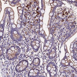 Invitrogen AP3M1 Polyclonal Antibody 100 &mu;L; Unconjugated:Antibodies,