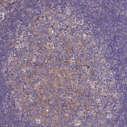 Invitrogen AP3M1 Polyclonal Antibody 100 &mu;L; Unconjugated:Antibodies,