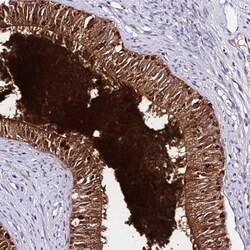 Invitrogen DEFB106A Polyclonal Antibody 100 &mu;L; Unconjugated:Antibodies,