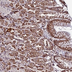 Invitrogen AMER3 Polyclonal Antibody 100 &mu;L; Unconjugated:Antibodies,