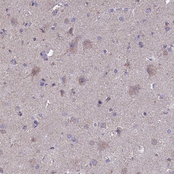 Invitrogen OR2W3 Polyclonal Antibody 100 &mu;L; Unconjugated:Antibodies,