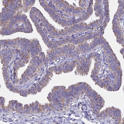 Invitrogen OR2W3 Polyclonal Antibody 100 &mu;L; Unconjugated:Antibodies,