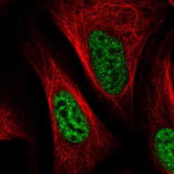 Invitrogen SNRPA1 Polyclonal Antibody 100 &mu;L; Unconjugated:Antibodies,