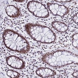 Invitrogen SNRPA1 Polyclonal Antibody 100 &mu;L; Unconjugated:Antibodies,