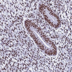 Invitrogen SNRPA1 Polyclonal Antibody 100 &mu;L; Unconjugated:Antibodies,